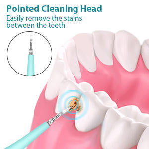 Electric Dental Calculus Remover – Sonic Tooth Tartar & Plaque Removal Kit, Safe Stain Cleaner for Adults & Kids – Multi-Speed Oral Care Tool