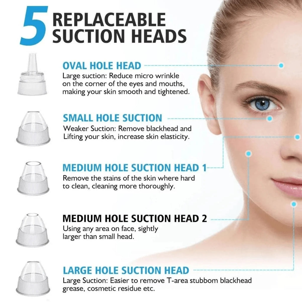 Electric Blackhead Vacuum Remover - Pore Cleanser & Pimple Sucker for Spa-Quality Facial at Home