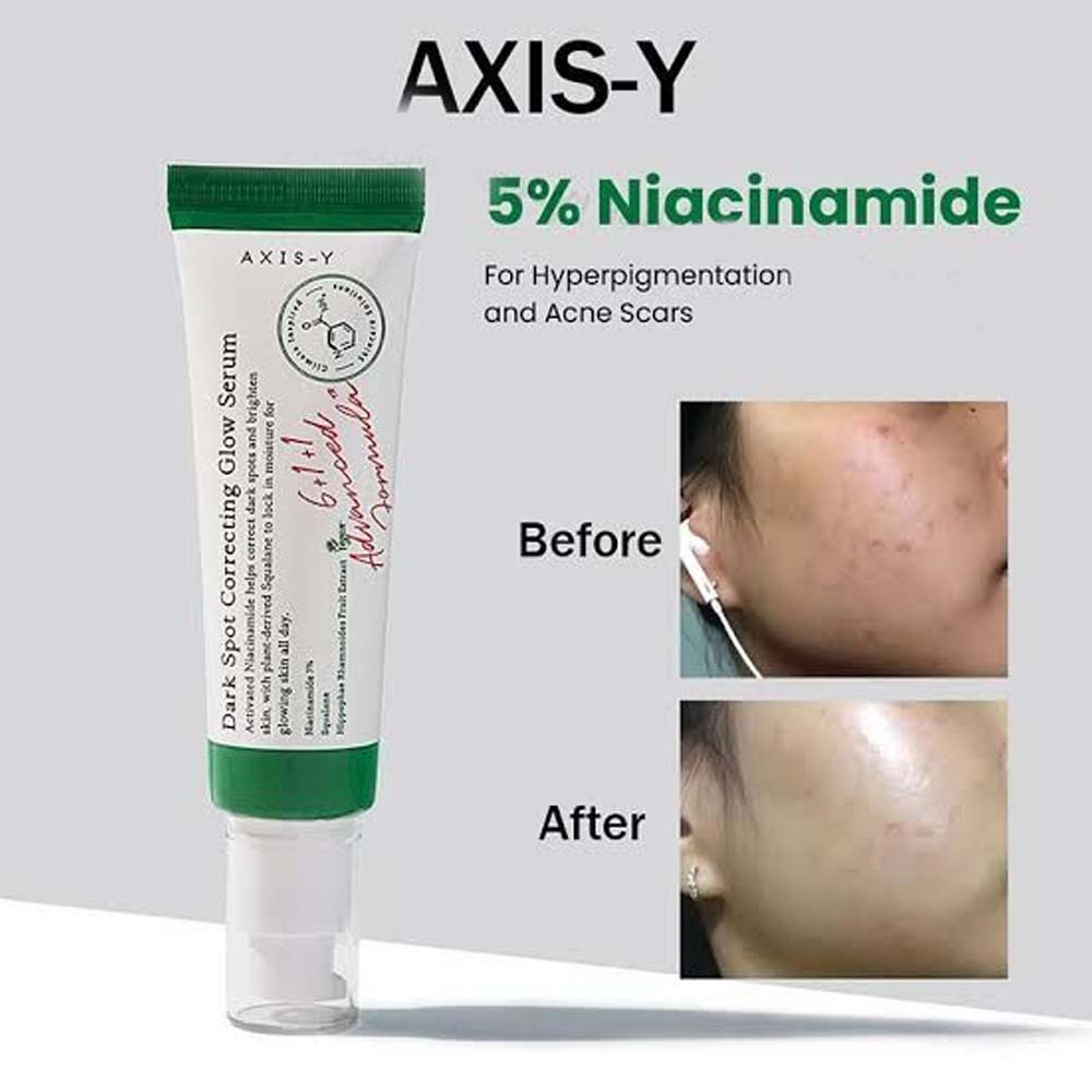 AXIS-Y Dark Spot Correcting Glow Serum - 50ml Brightening Treatment for Hyperpigmentation, Uneven Skin Tone & Dark Spots