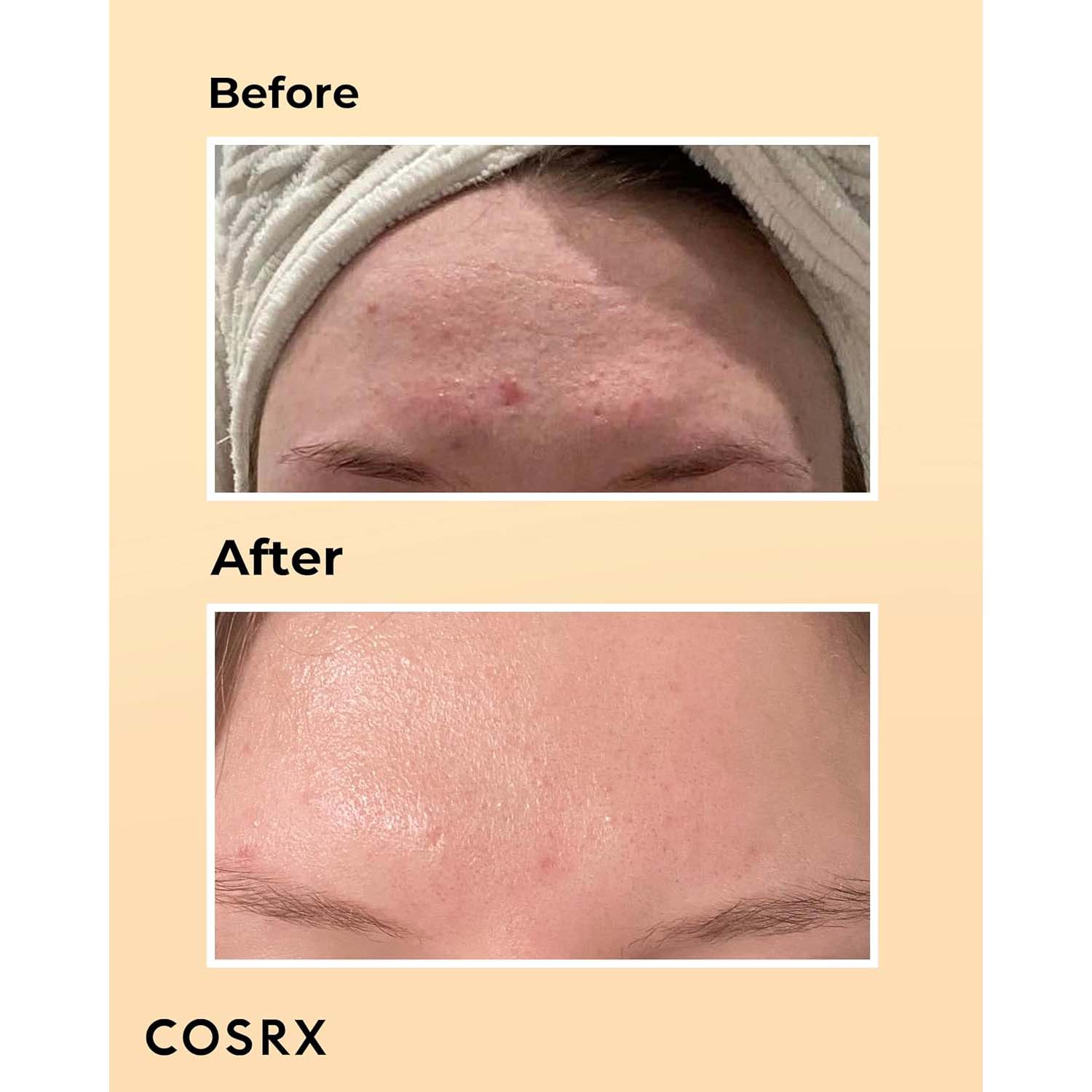 COSRX Advanced Snail 96 Mucin Power Essence. Hydrating & repairing snail secretion filtrate for plump, glowing skin. 100ml.