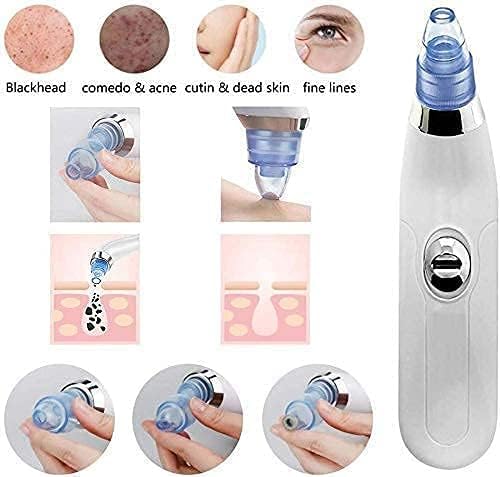 Electric Blackhead & Whitehead Remover | Deep Cleansing Pore Purifier for Spa-Like Facial Care