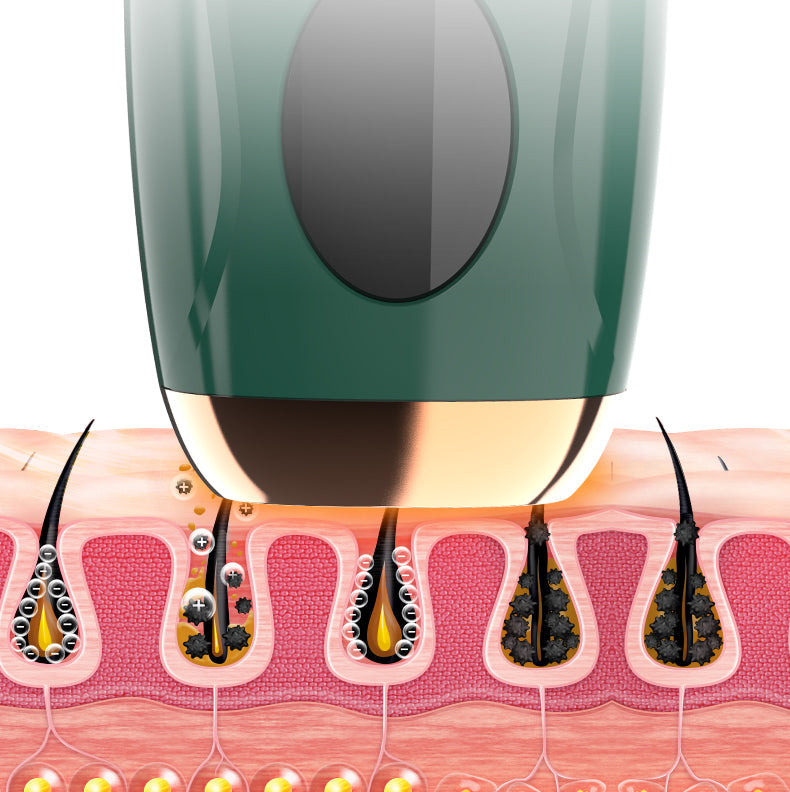 IPL Hair Removal Device – At-Home Painless Laser Hair Remover for Men & Women | Full Body Hair Reduction for Face, Bikini, Legs, Arms, & Underarms