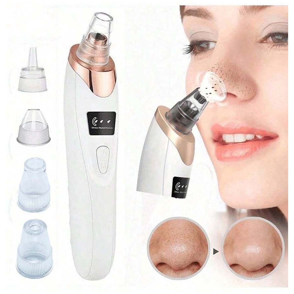 Electric Blackhead Vacuum Remover - Pore Cleanser & Pimple Sucker for Spa-Quality Facial at Home